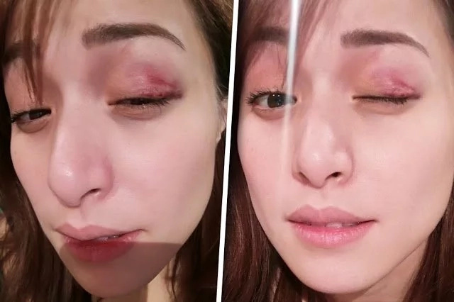 Ali Khatibi on wife Christine's accident - 'Medyo nainis ako' Ali Khatibi on wife Christine's accident - 'Medyo nainis ako'