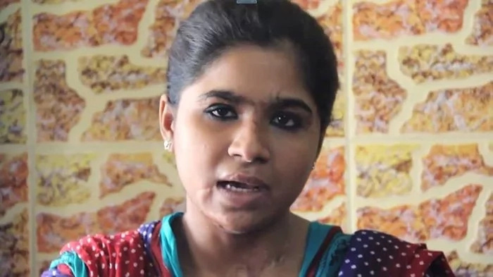 Love heals! Two acid-attack survivors fall in love and now plan to marry each other in June (photos) Love heals! Two acid-attack survivors fall in love and now plan to marry each other in June (photos)