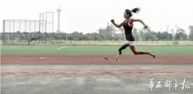 This 22 year old woman lost her leg, but that doesn’t stop her grom doing this! This 22 year old woman lost her leg, but that doesn’t stop her grom doing this!