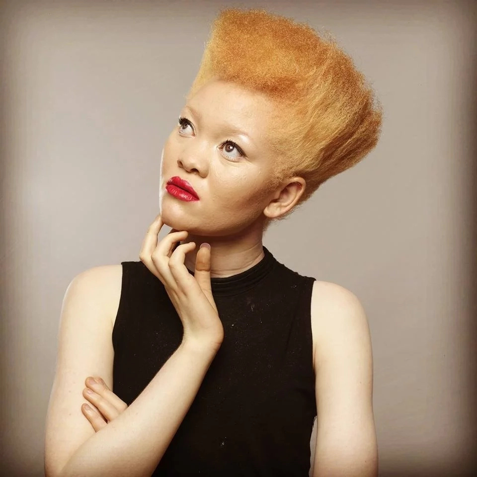 This Kenyan model living with Albinism is redefining beauty