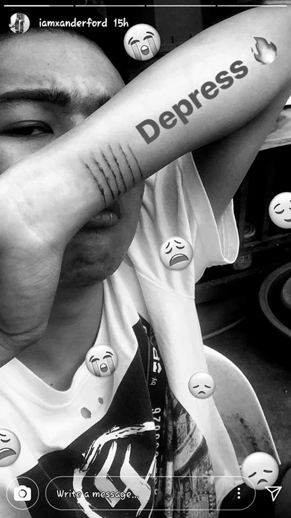 Depressed? Xander Ford posts photo showing his wrist with cuts Depressed? Xander Ford posts photo showing his wrist with cuts
