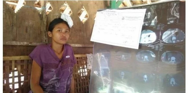 Indonesian woman gets SHOCKING NEWS that she had a kidney removed without her knowledge (photos, video) Indonesian woman gets SHOCKING NEWS that she had a kidney removed without her knowledge (photos, video)