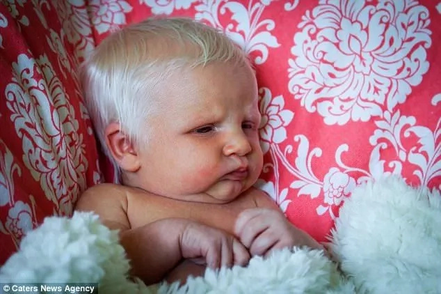 This baby looks like the character in Game of Thrones (photos) This baby looks like the character in Game of Thrones (photos)