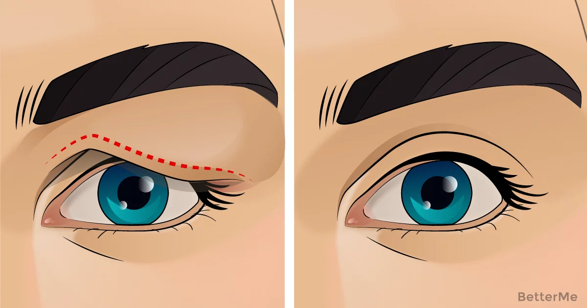what is good for sagging eyes
