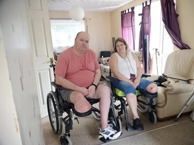 Coincidence? This couple cancelled their wedding because BOTH had to AMPUTATE their legs