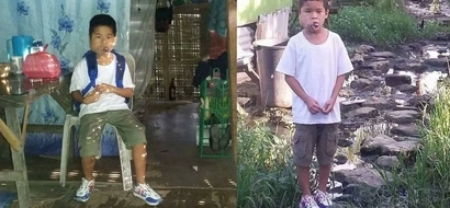 This innocent Pinoy child who gets bullied at school because of his strange-looking mouth is gently knocking on your kind hearts