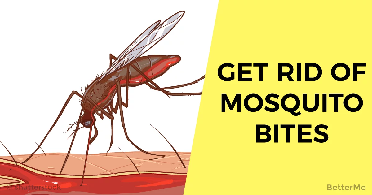 stop mosquito bite itch