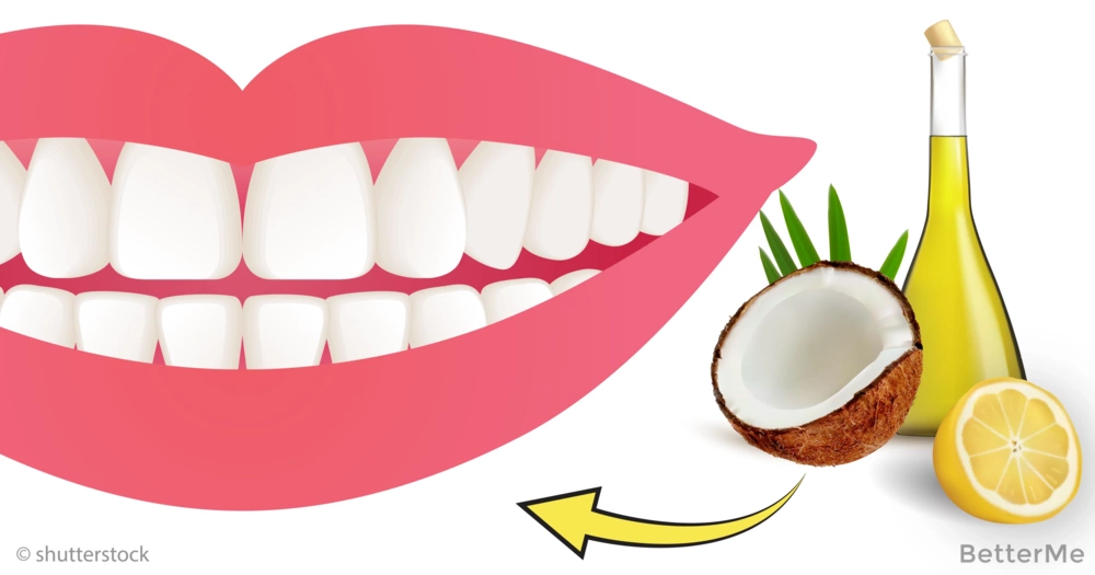 6 Ways to Naturally Whiten Your Teeth ile ilgili görsel sonucu