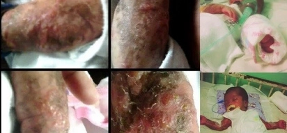 Ipagdasal n'yo po si baby! Mom pleads for prayer as genetic disorder sends this baby girl into comatose