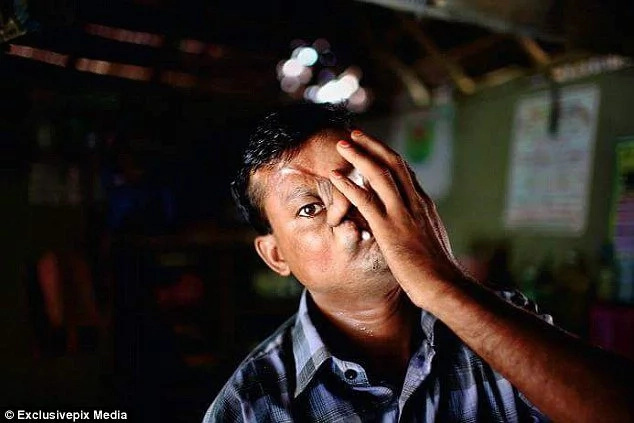 Tiger destroys fisherman's face after horrendous attack! Tiger destroys fisherman's face after horrendous attack!