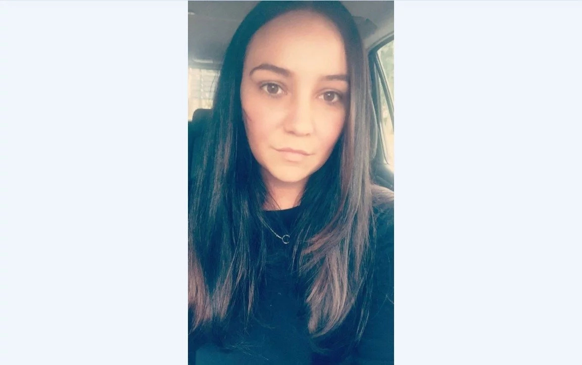 Woman, 25, left with permanent scars and facial twitches after female thug glassed her for smiling at her in a bar Woman, 25, left with permanent scars and facial twitches after female thug glassed her for smiling at her in a bar