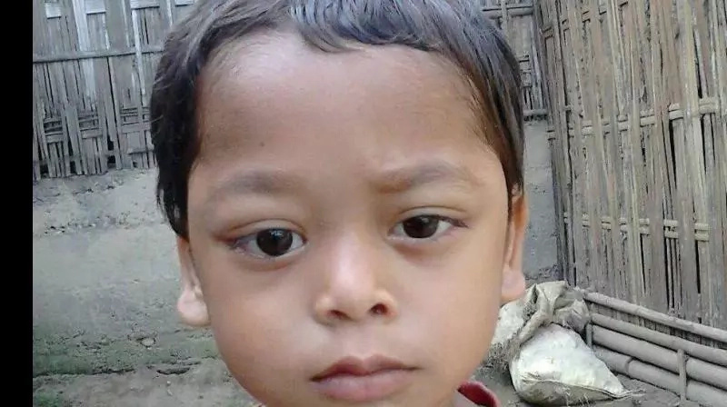 This Indian boy's eyes bleed and pop out of their sockets! This Indian boy's eyes bleed and pop out of their sockets!