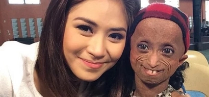 19-year-old girl with aging disease dies, survived 5 years more than average