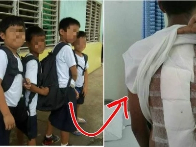 Parents, don't make your children bring heavy backpacks to school - they might end up just like this kid!