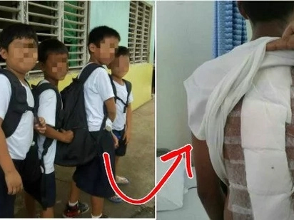 Parents, don't make your children bring heavy backpacks to school - they might end up just like this kid!