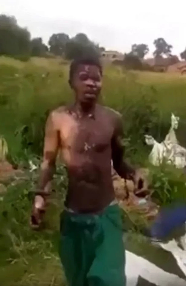 Indestructible! Man hit with 30000 volts of electricity, falls to the ground and SURVIVES (photos, video) Indestructible! Man hit with 30000 volts of electricity, falls to the ground and SURVIVES (photos, video)