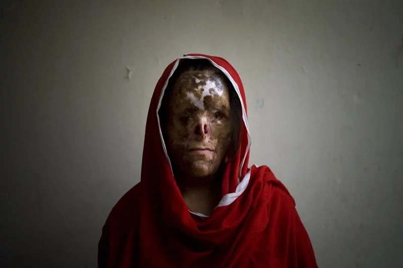 These Pakistani women rejected marriage proposals and you will be shocked what they got in return These Pakistani women rejected marriage proposals and you will be shocked what they got in return