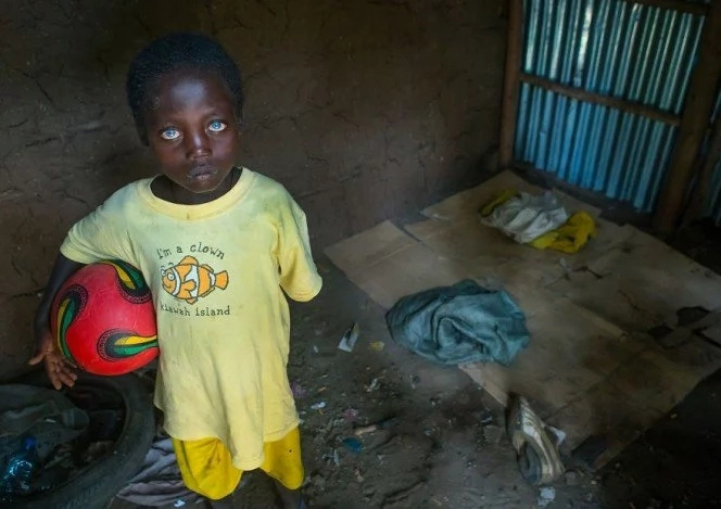 African boy, 8, has rare condition that makes his eyes a mesmerizing BLUE (photos)