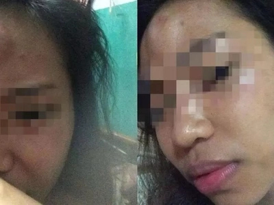 Enraged netizen who experiences abuse from BF encourages women to stand up for their rights