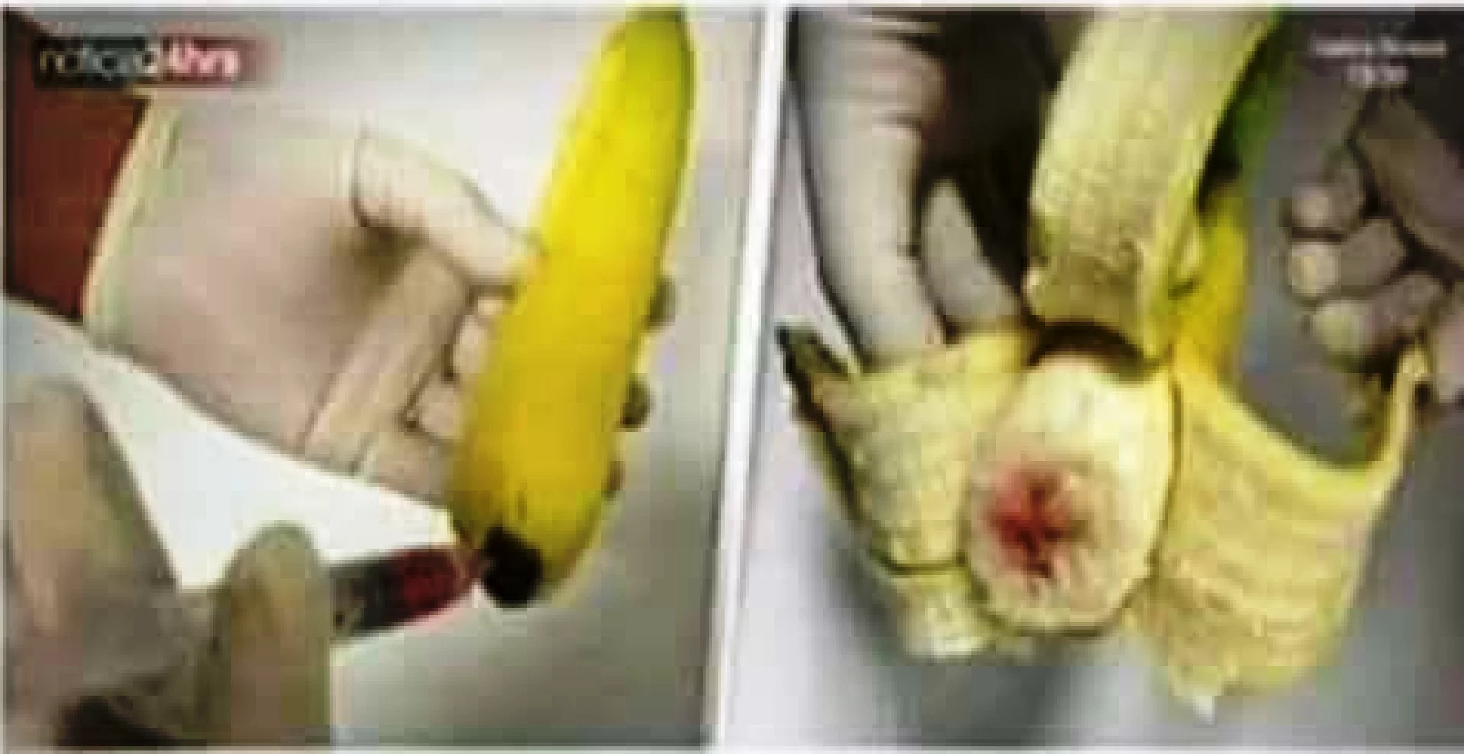 Netizens warned everyone of bananas injected with AIDS and HIV infected blood Netizens warned everyone of bananas injected with AIDS and HIV infected blood