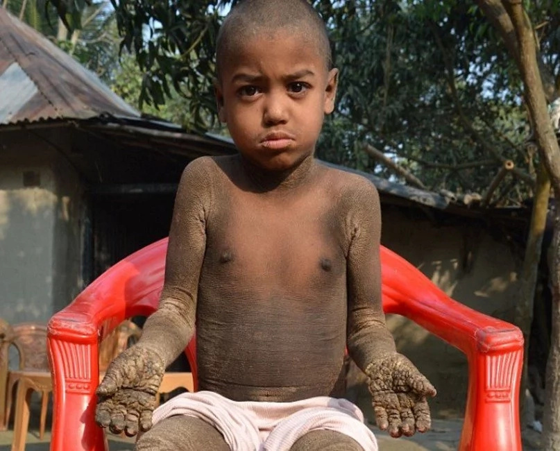 Boy, aged 8, turns into STONE and forced to stay home as kids detest him (photos, video)