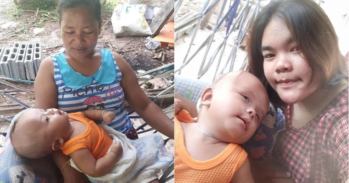 Tragedy as parents abandon 8-month old toddler living with a two-inch deep crack in the top of his head Tragedy as parents abandon 8-month old toddler living with a two-inch deep crack in the top of his head