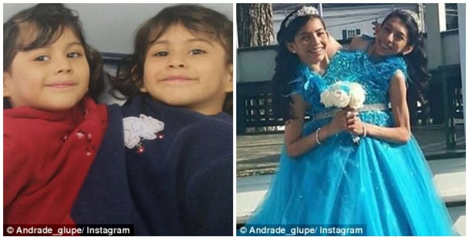 See extraordinary life of conjoined twins, 16, who say no to separation See extraordinary life of conjoined twins, 16, who say no to separation