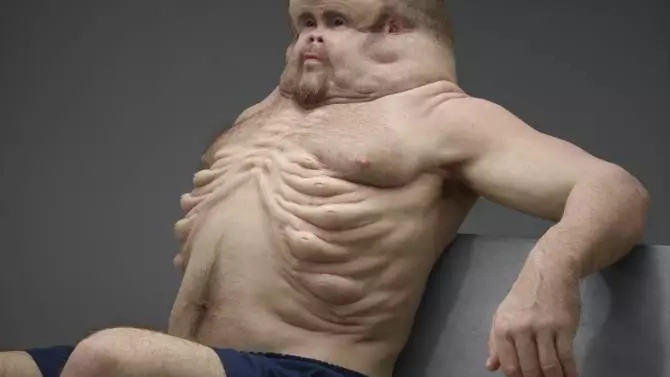 Has Science Gone Too Far? Meet Graham: the man designed against car crashes! Has Science Gone Too Far? Meet Graham: the man designed against car crashes!