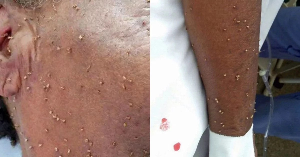 84-year-old woman dies after being stung more than 500 times by swarm of bees (photos)