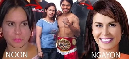 Parang hindi siya! These shocking before and after photos of Jinkee Pacquiao prove what money can do! Watch!