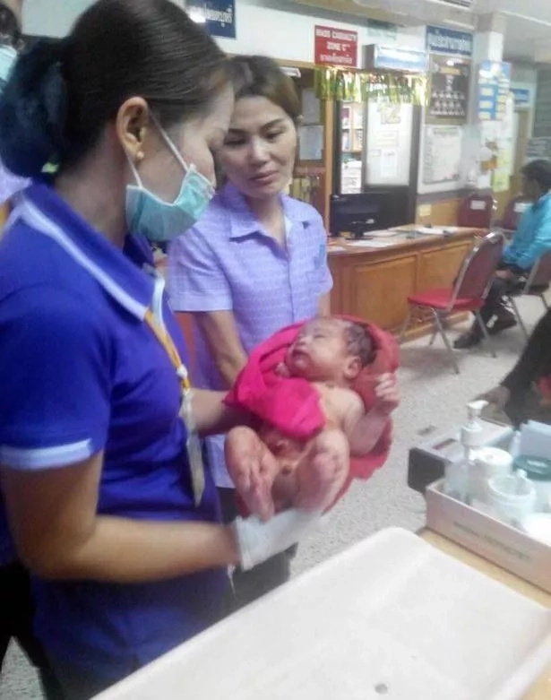 Baby survives miraculously despite being buried alive and stabbed 14 times by mother Baby survives miraculously despite being buried alive and stabbed 14 times by mother