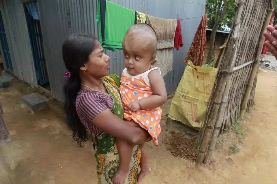 Dying child outlives parents' predictions about her life Dying child outlives parents' predictions about her life