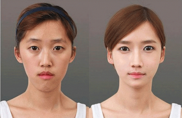 These women tried plastic surgery. The result? Shocking! These women tried plastic surgery. The result? Shocking!