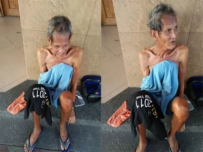 This man from Mercedes, Daet, Camarines Norte needs help!