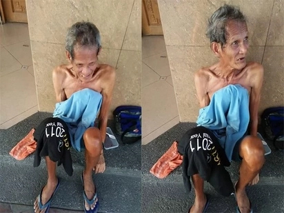 This man from Mercedes, Daet, Camarines Norte needs help!