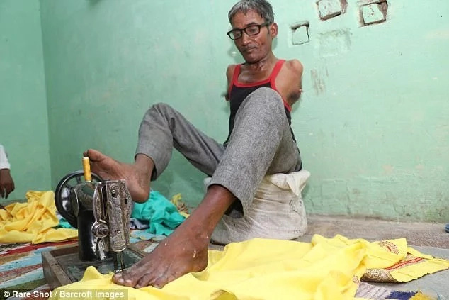 Inspirational: Madan Lal has defied the odds. Photo: Barcroft Images Inspirational: Madan Lal has defied the odds. Photo: Barcroft Images