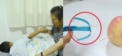 Boy’s eye shot with toothpick by his classmate. Eyesight permanently damaged