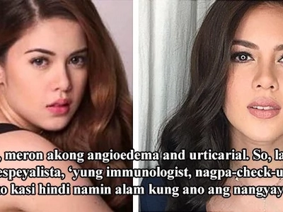 “Nagpa-check-up na ako”: Shaina Magdayao opens up about her health issues, says stress makes her condition flare-up
