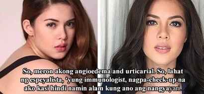 “Nagpa-check-up na ako”: Shaina Magdayao opens up about her health issues, says stress makes her condition flare-up