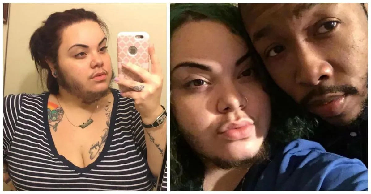 Woman who has beard since age of 16 embraces her facial hair and her boyfriend LOVES it (photos)