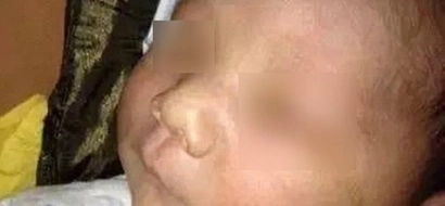 You won’t believe what SIMPLE mistake caused this infant to be BLIND