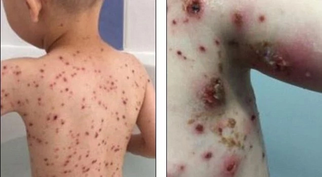 Horrifying Pictures Show Why You NEVER Give A Child Ibuprofen Horrifying Pictures Show Why You NEVER Give A Child Ibuprofen