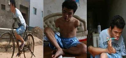 Walang awa! Heartless banks refuse armless man loan because he had no fingerprint