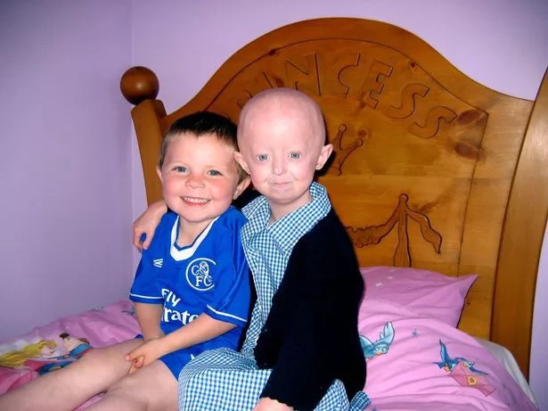 This teen trapped in a 104-year-old’s body but tried to fight with fate This teen trapped in a 104-year-old’s body but tried to fight with fate