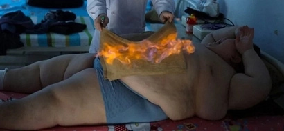 Desperado na magpapayat! 330lb Chinese boy is set on fire to help lose weight