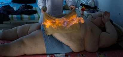 Desperado na magpapayat! 330lb Chinese boy is set on fire to help lose weight