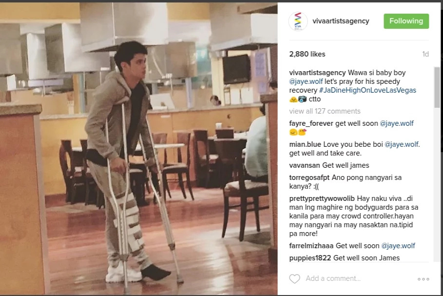 James Reid injured by fan James Reid injured by fan