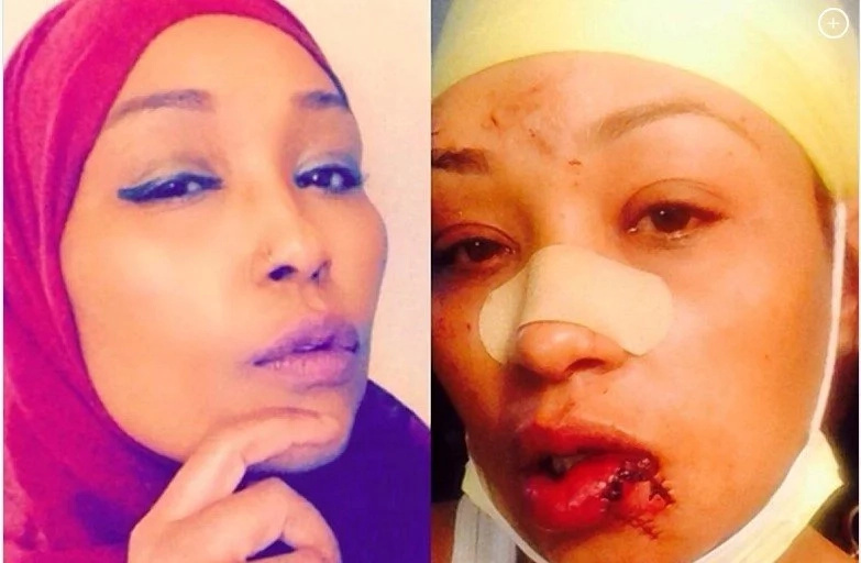 Minnesota Woman Pleads Guilty To Assault Of Applebee’s Customer For Not Speaking English Minnesota Woman Pleads Guilty To Assault Of Applebee’s Customer For Not Speaking English