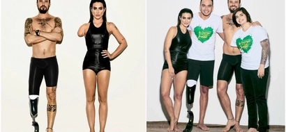Internet went nuts about photoshoot transforming able-bodied models into amputees to promote Paralympics