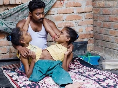 Conjoined twins fall in love with the same man after 46 years of being single and rejected